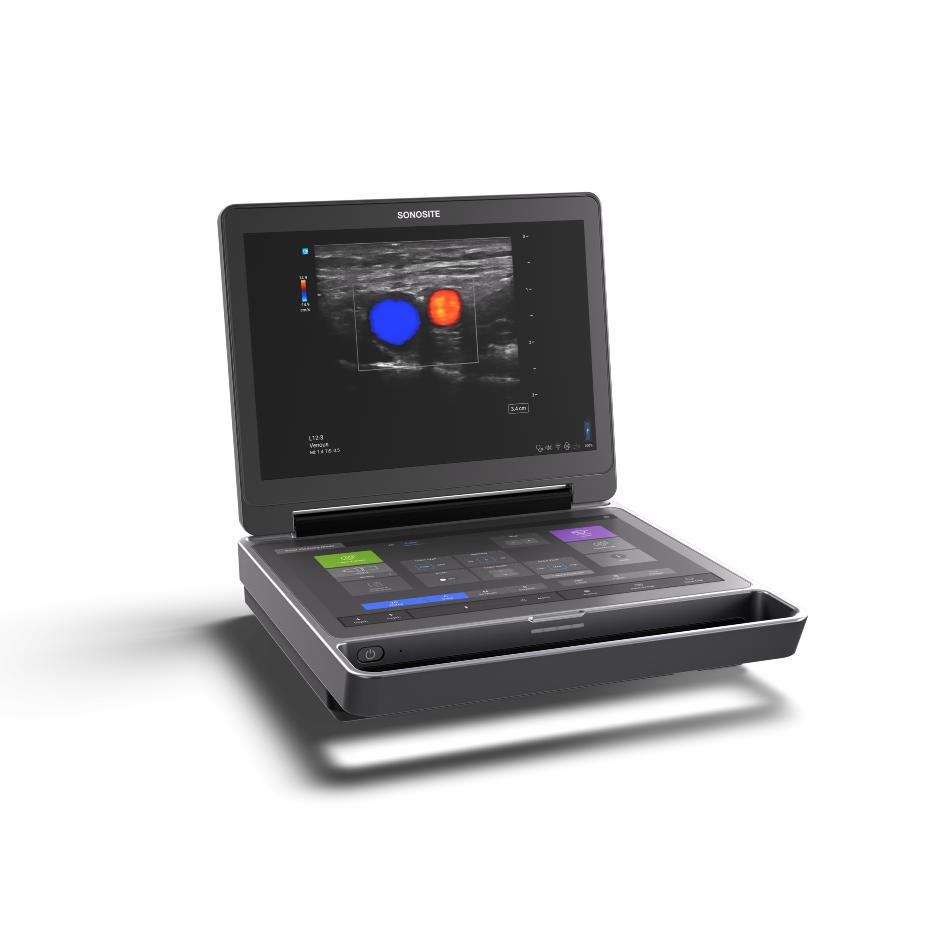 Sonosite MT | Ultralydsscanner